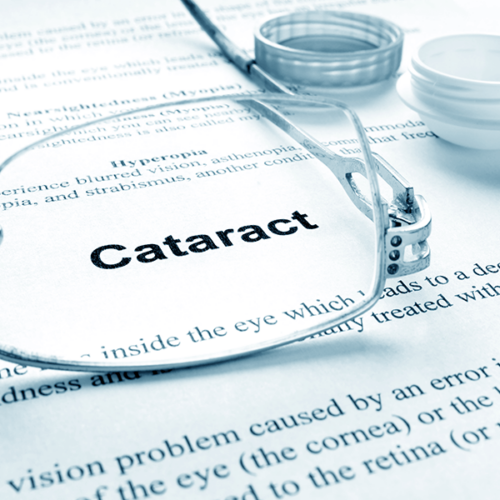 Cataracts