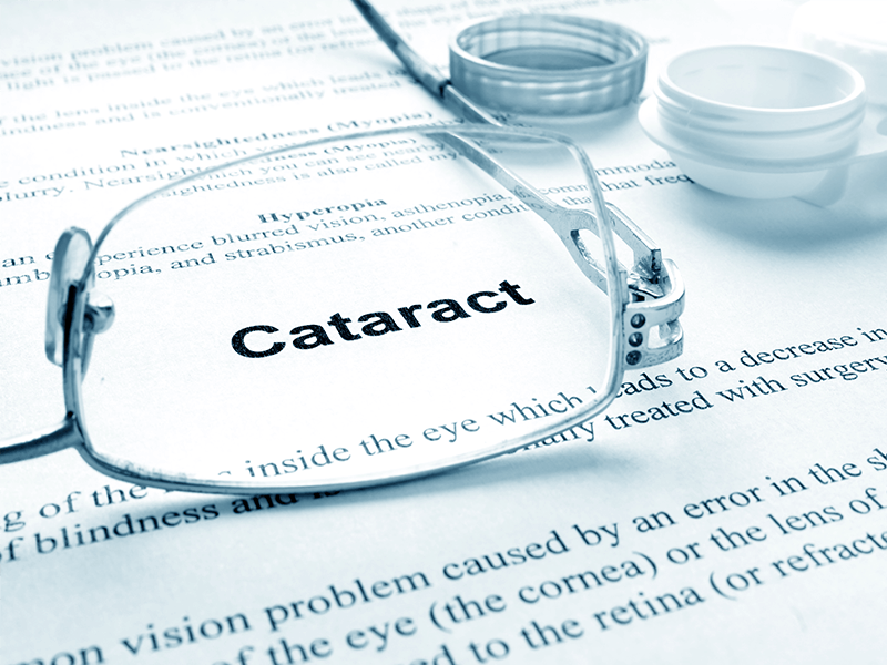 Cataracts