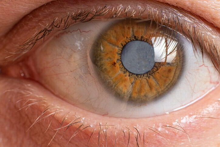 Common Eye Problems (featured image)