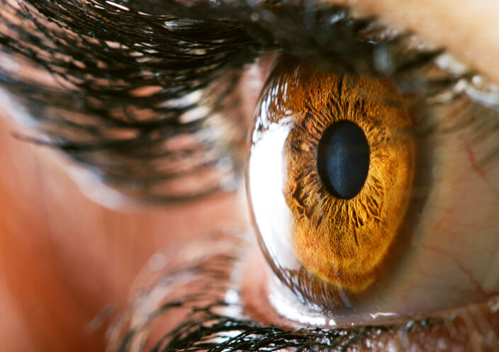 Corneal Reshaping Therapy