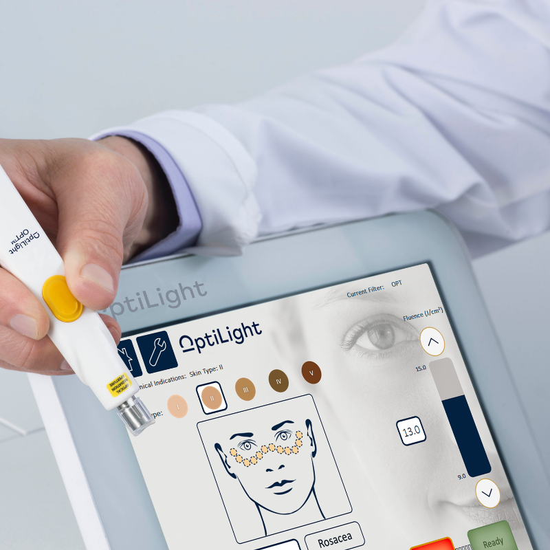 OptiLIGHT - Dry Eye Medical Device